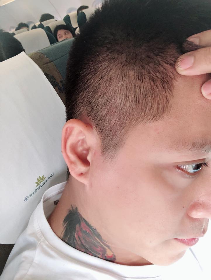 Tuấn Hưng không ngại công khai bệnh tật dù phát điên, buồn và suy sụp