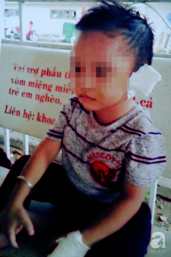 Bà ngoại bé 3 tuổi nghi bị mẹ ruột và cha dượng bạo hành ở Bình Dương: Tôi sợ nó điên lên lại đánh chết thằng bé