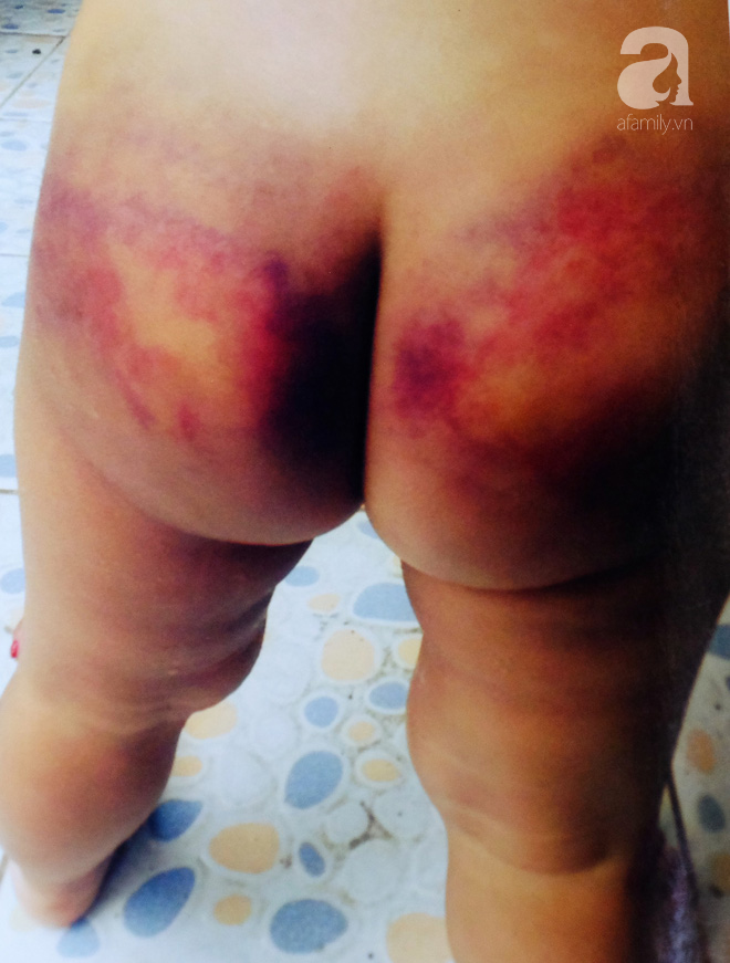 Bà ngoại bé 3 tuổi nghi bị mẹ ruột và cha dượng bạo hành ở Bình Dương: Tôi sợ nó điên lên lại đánh chết thằng bé