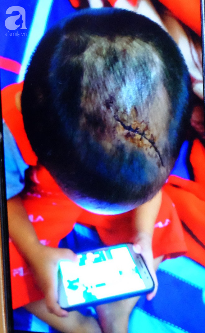 Bà ngoại bé 3 tuổi nghi bị mẹ ruột và cha dượng bạo hành ở Bình Dương: Tôi sợ nó điên lên lại đánh chết thằng bé