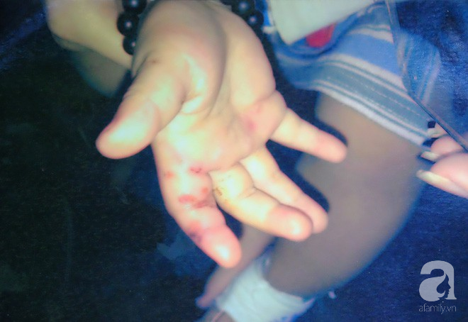 Bà ngoại bé 3 tuổi nghi bị mẹ ruột và cha dượng bạo hành ở Bình Dương: Tôi sợ nó điên lên lại đánh chết thằng bé