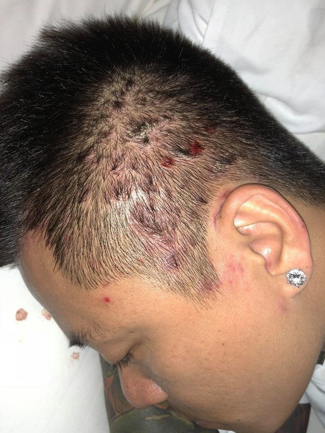 Căn bệnh ca sĩ Tuấn Hưng mắc nguy hiểm như thế nào?