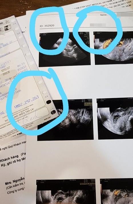 TP.HCM: Đến bệnh viện FV khám thai, người phụ nữ tố bị bác sĩ kê thuốc đẩy dịch ứ khiến mình băng huyết, mất con