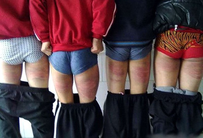 Bố tức giận đánh vào mông con khiến đứa trẻ qua đời và sự thật giật mình sau những màn yêu cho roi cho vọt