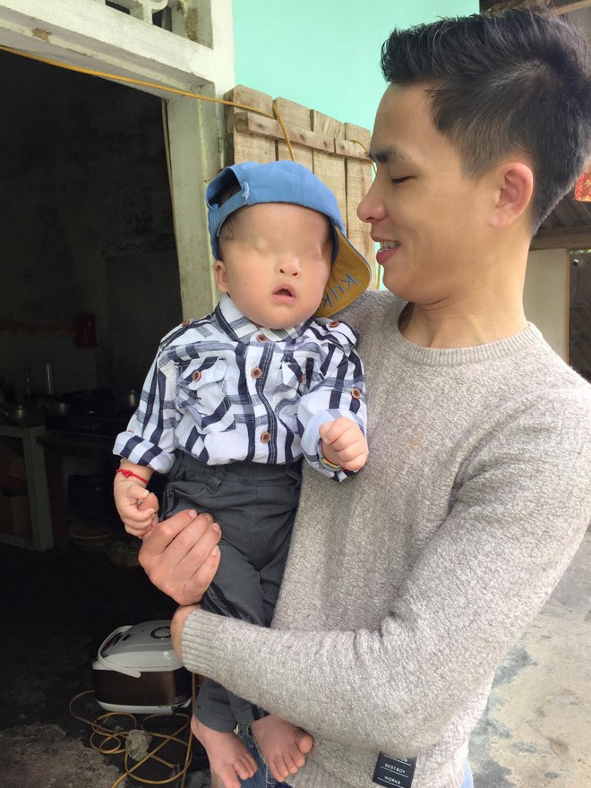 Cậu bé không có đôi mắt ở Nghệ An tuyệt vọng khi bác sĩ tại Singapore kết luận về cơ hội nhìn thấy ánh sáng