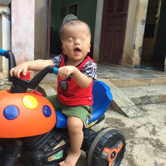 Cậu bé không có đôi mắt ở Nghệ An tuyệt vọng khi bác sĩ tại Singapore kết luận về cơ hội nhìn thấy ánh sáng