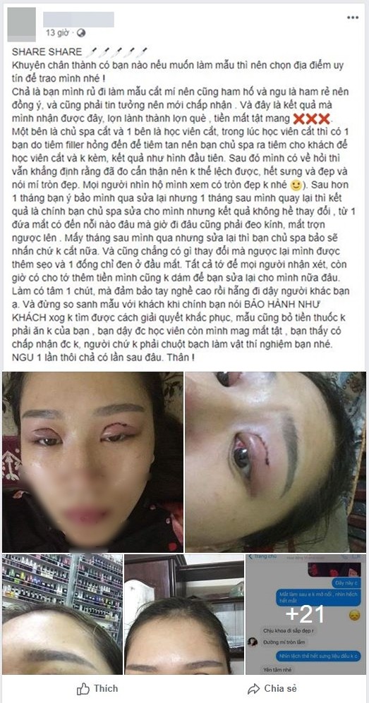 Nghe bạn rủ rê đến spa làm mẫu cắt mí mắt cho rẻ, mẹ trẻ đau đớn khi bỗng dưng lợn lành thành lợn què