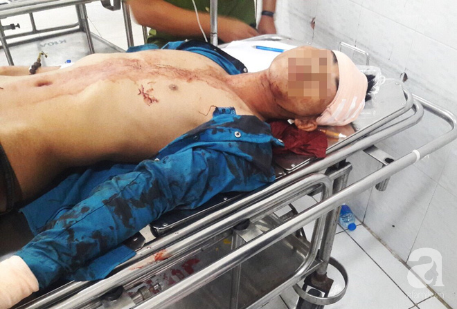 TP.HCM: Nghĩ bạn gái quen người khác, nam thanh niên rủ bạn nhậu chặn xe đánh chém tình địch dã man