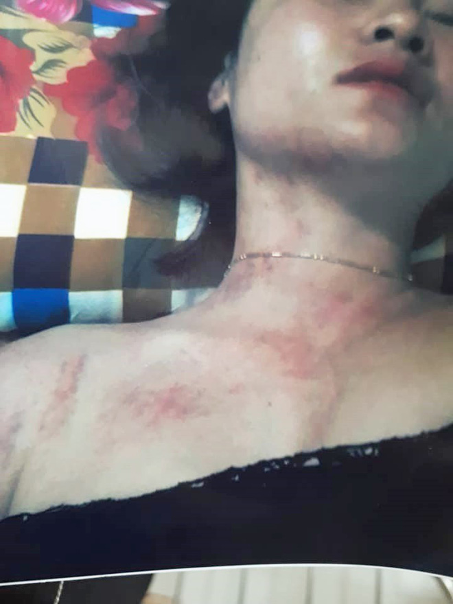 Tình tiết bất ngờ vụ vợ lên FB tố bị bạo hành: Người chồng khẳng định tất cả chỉ là chiêu trò của vợ