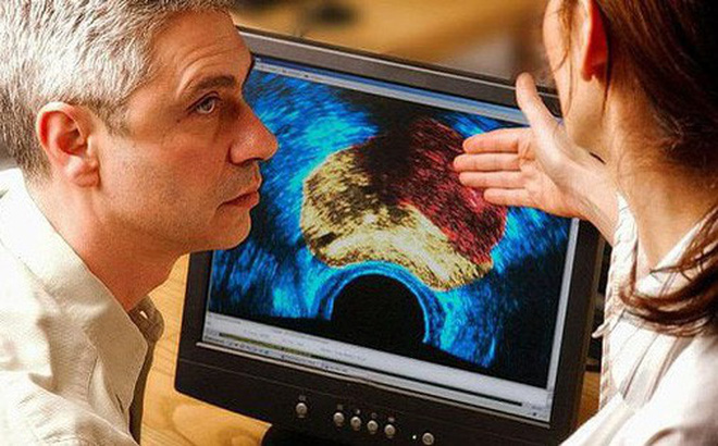 Quá nam tính sẽ… dễ bị ung thư?