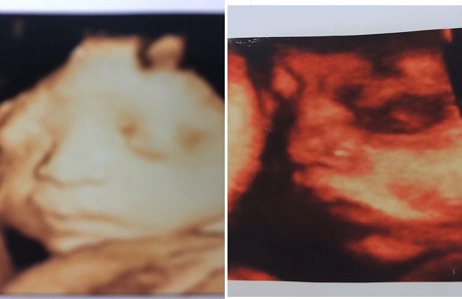 Những uẩn khúc quanh vụ vợ mang thai đôi, đi đẻ nhưng không mang con về khiến chồng quẫn trí tự tử ở Bắc Giang