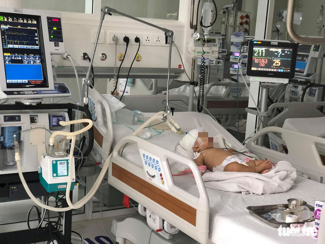 Bé gái 14 tháng tuổi bị khỉ xổng chuồng cạp lún sọ