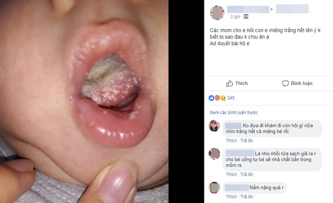 Con có bệnh trong miệng, đau không chịu ăn, mẹ bị mắng tới tấp vì không đưa đi khám còn lên Facebook hỏi các mẹ ơi