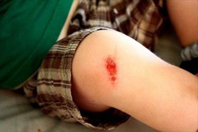 Chàng trai tử vong sau khi cắt móng chân, bác sĩ nói nếu làm sớm điều này thì đã sống