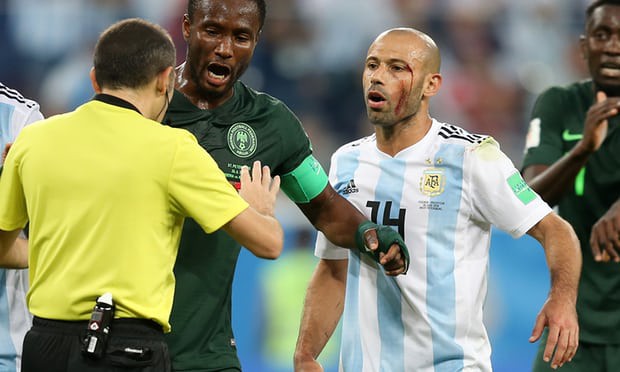 Muốn hạ Pháp, Argentina cần những người dám đổ máu vì vinh quang