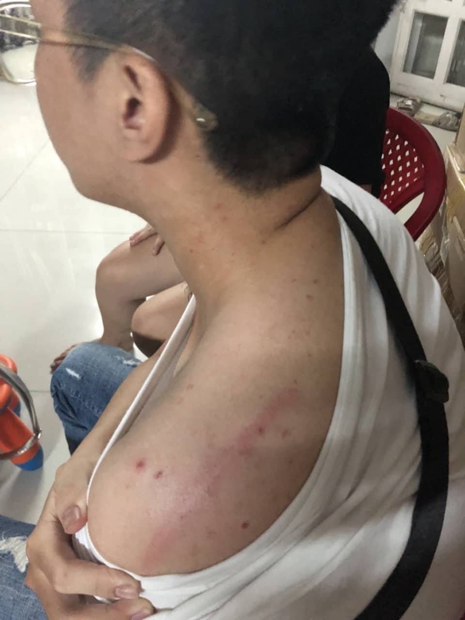 Thanh niên 19 tuổi cùng bạn gái bị nhóm người hành hung, cưỡng đoạt tài sản rồi bắt ký giấy nợ 400 triệu đồng