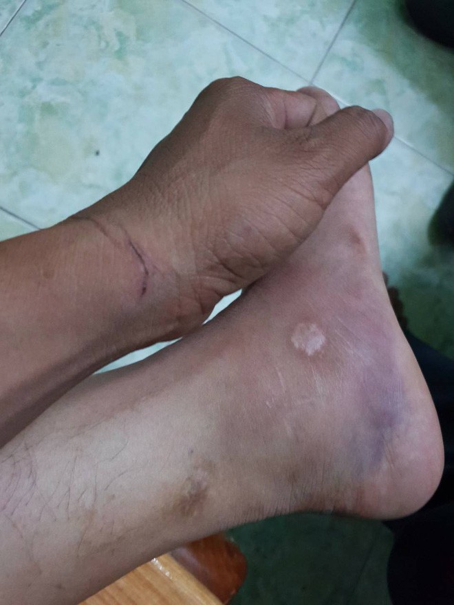 Vụ công an còng tay người làm đường giúp dân: Có người đứng sau chi tiền thuê nhà hảo tâm?