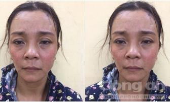 Nhiều quý ông sập bẫy kỹ thuật viên massage