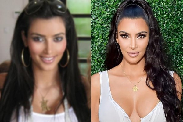 Tự tin khoe ảnh quá khứ, 3 chị em nhà Kardashian Jenner liền bị soi nhan sắc dao kéo
