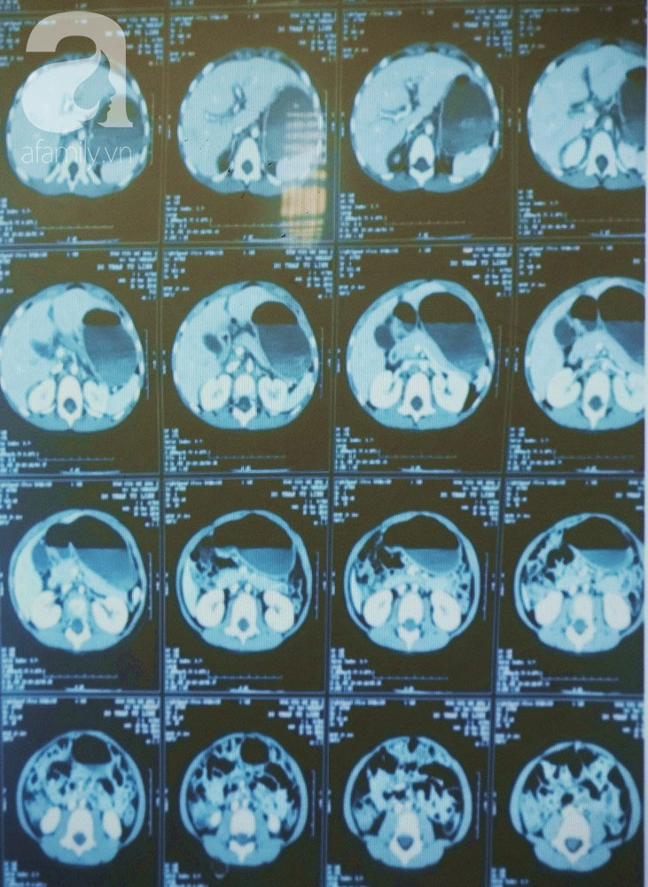 TP.HCM: Đang tắm cho con lớn, mẹ bàng hoàng phát hiện con nhỏ 4 tuổi rơi từ tầng 7 xuống đất nguy kịch