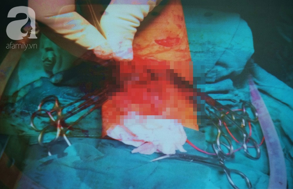 TP.HCM: Đang tắm cho con lớn, mẹ bàng hoàng phát hiện con nhỏ 4 tuổi rơi từ tầng 7 xuống đất nguy kịch