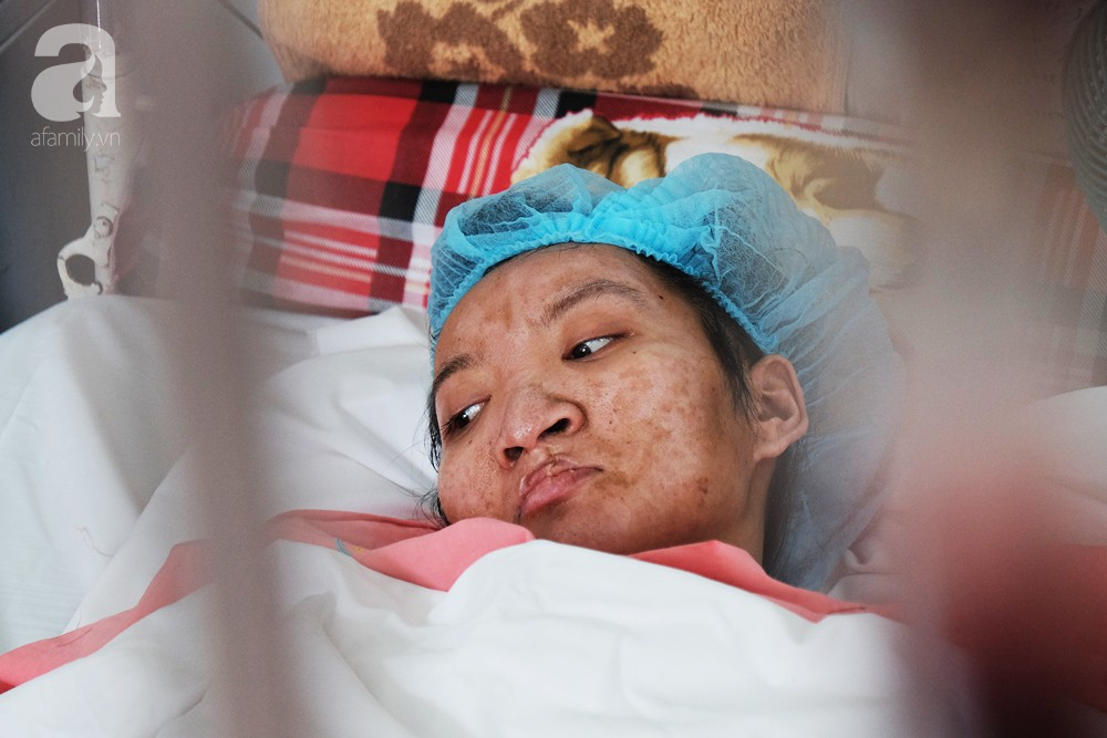 TP.HCM: Thương tâm cảnh thai phụ trẻ và người yêu bỏng nặng vì cháy nhà trước ngày cưới