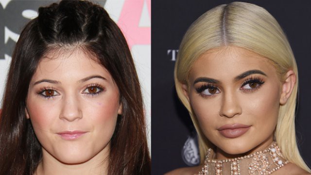Kylie Jenner than phiền vì vòng 1 to gấp ba lần sau khi sinh con