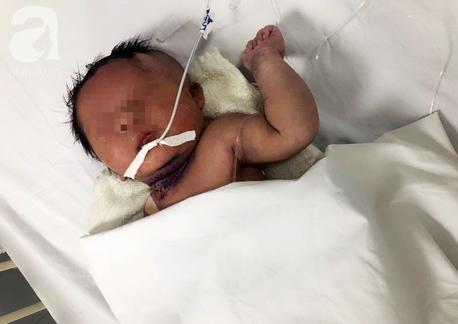 Bé trai 5 ngày tuổi đang khỏe mạnh bỗng ọc máu, suy hô hấp và hôn mê vì căn bệnh rất hiểm