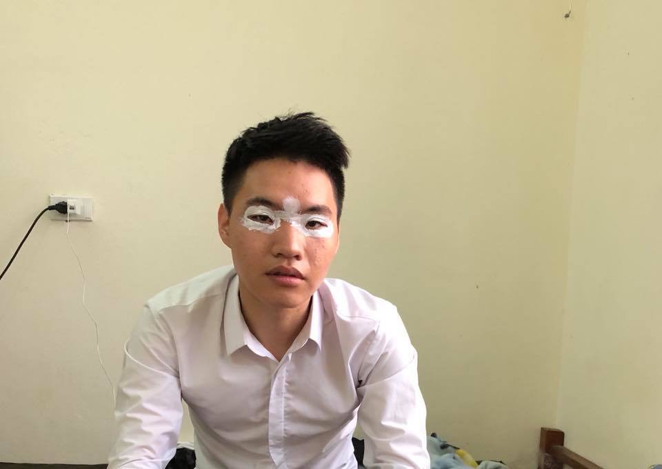 Mùa kiến ba khoang lại đến, dân mạng kêu trời vì bị đốt để rồi phải trang điểm bằng thuốc đặc trị