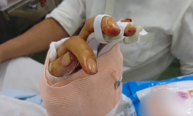 Vết thương khủng khiếp của 2 người phụ nữ bị gã cuồng yêu nã súng