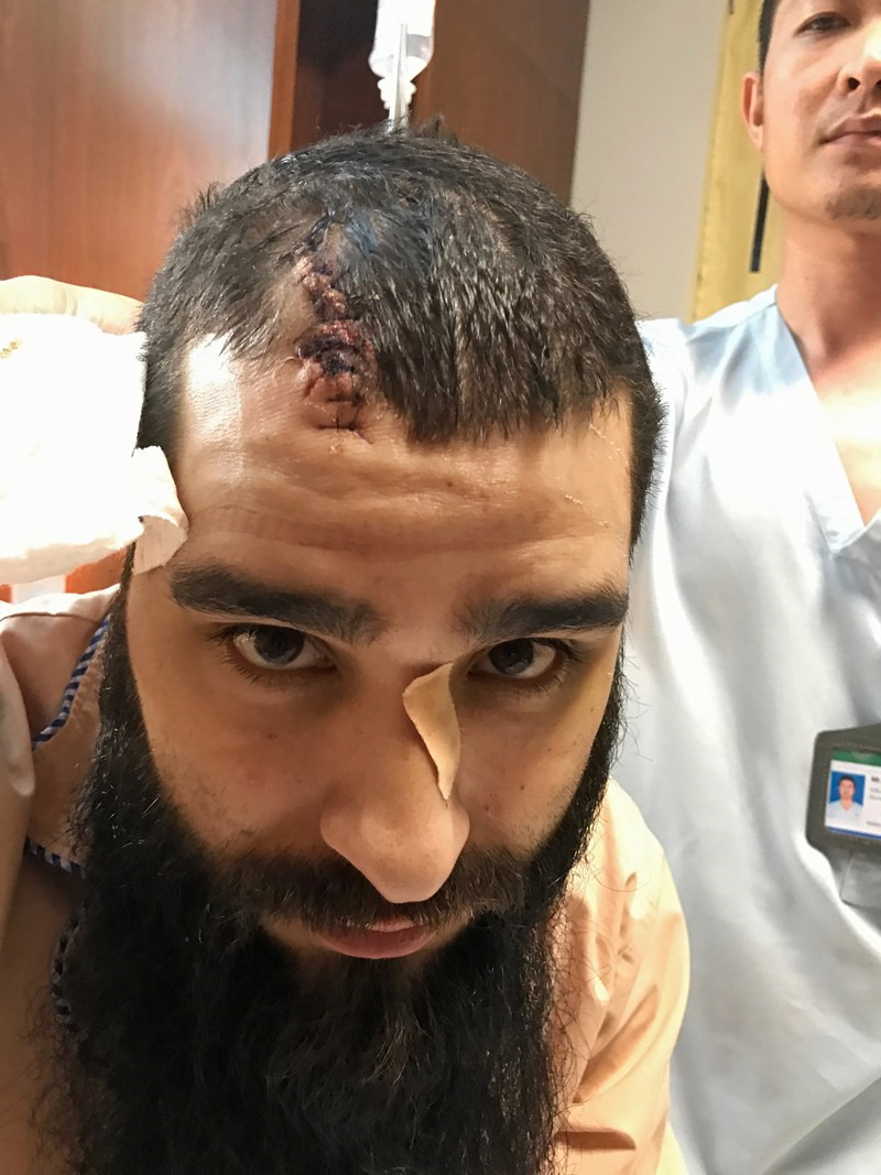 Đạo diễn Kong: Tôi suýt bị giết chết ở VN và sẽ tìm ra hung thủ