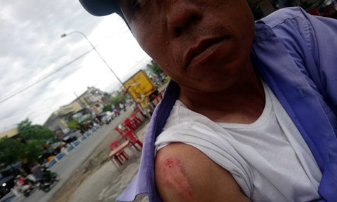 GrabBike và xe ôm truyền thống hỗn chiến, một người bị thương