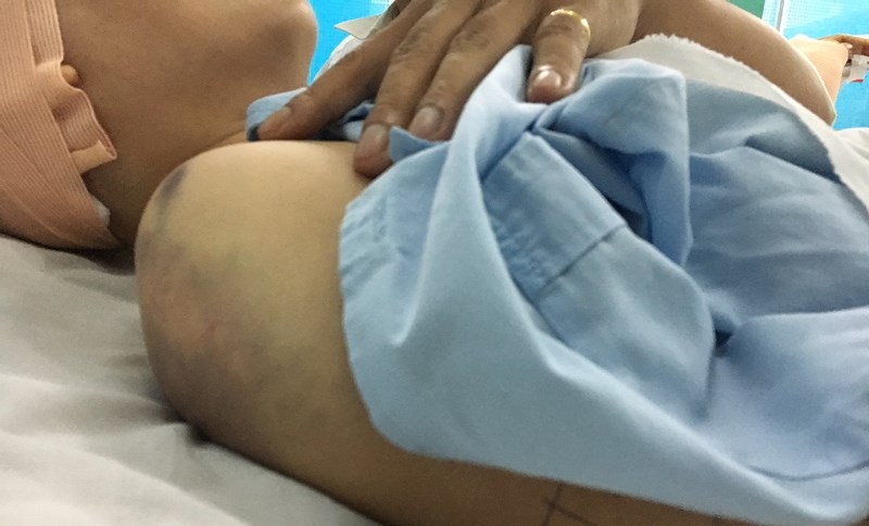 Kinh hoàng lời kể người sống sót trong vụ ghen tuông nổ súng