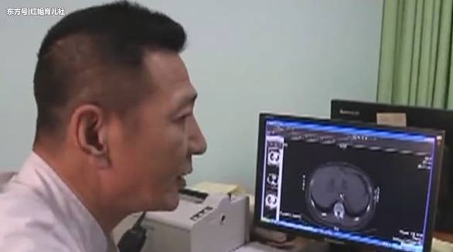 Hàng chục vật lạ xuất hiện trong ổ bụng cậu bé 13 tuổi sau khi uống 2 cốc trà sữa Hàng chục vật lạ xuất hiện trong ổ bụng cậu bé 13 tuổi sau khi uống 2 cốc trà sữa