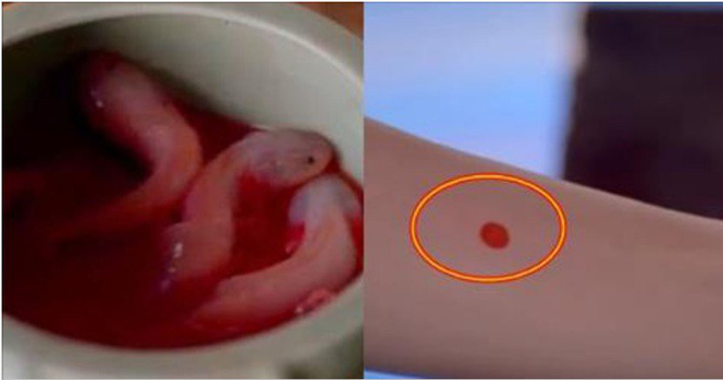 Sự thật ám ảnh về thủ cung sa, thủ thuật kiểm tra trinh tiết của phụ nữ thời xưa Sự thật ám ảnh về thủ cung sa, thủ thuật kiểm tra trinh tiết của phụ nữ thời xưa