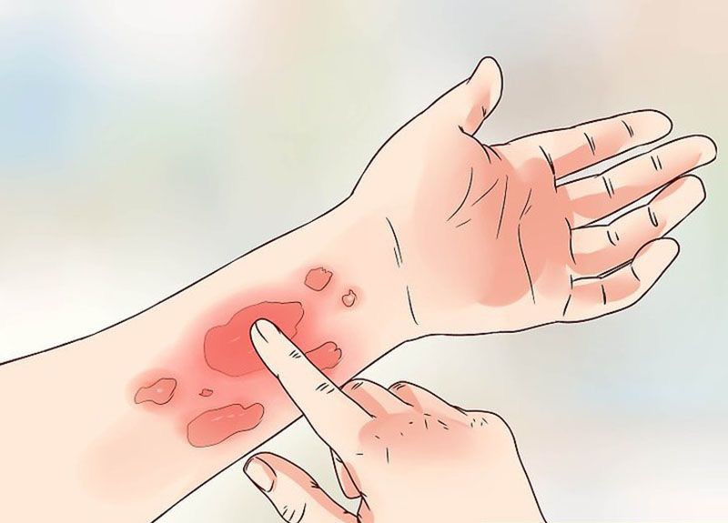 Hà Nội lại mưa dài ngày, cẩn thận quần áo ngấm mưa có thể gây ra 4 vấn đề sức khỏe tai hại sau