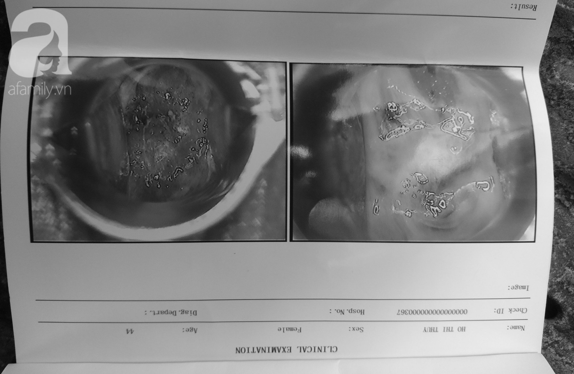 TP.HCM: Đi tháo vòng tránh thai, nữ bệnh nhân tố phòng khám đa khoa vẽ bệnh, dọa ung thư để lấy thêm tiền