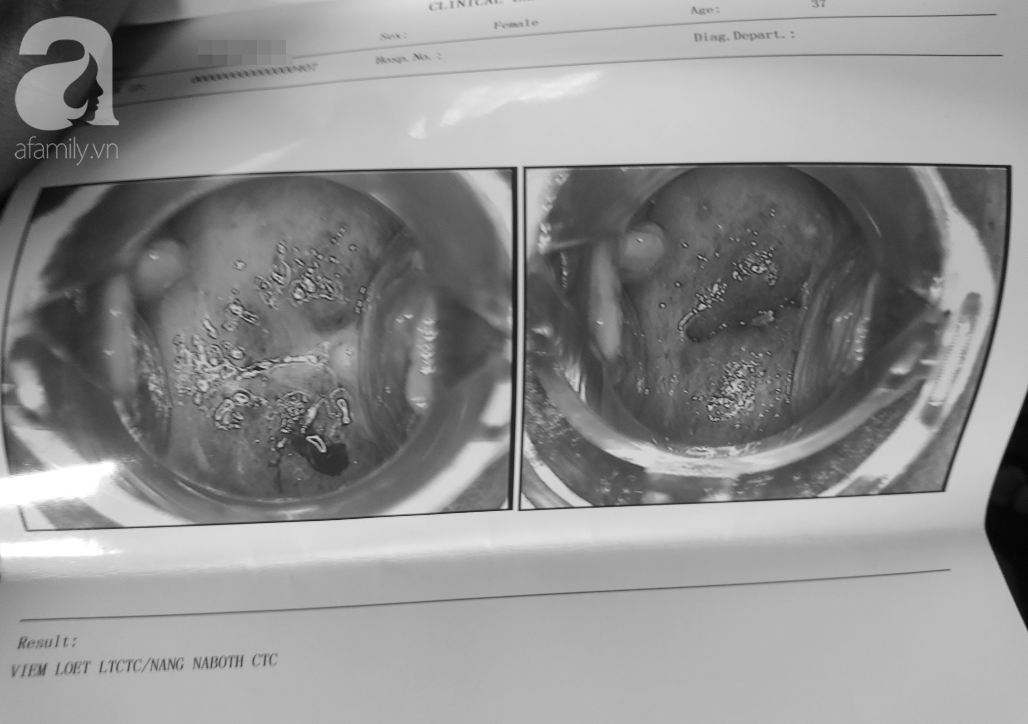 TP.HCM: Đi tháo vòng tránh thai, nữ bệnh nhân tố phòng khám đa khoa vẽ bệnh, dọa ung thư để lấy thêm tiền