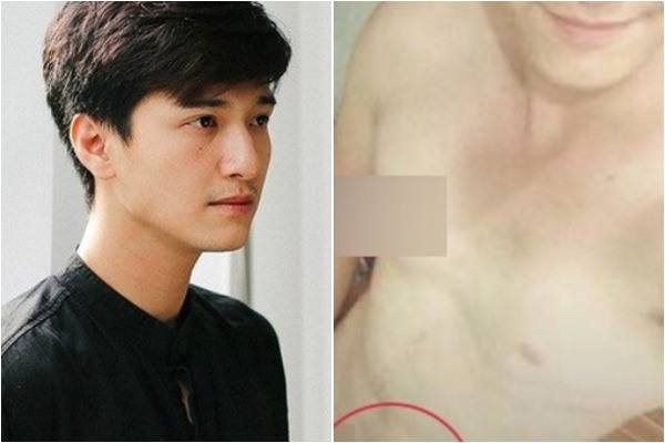 Huỳnh Anh nói gì trước nghi vấn lộ ảnh nóng