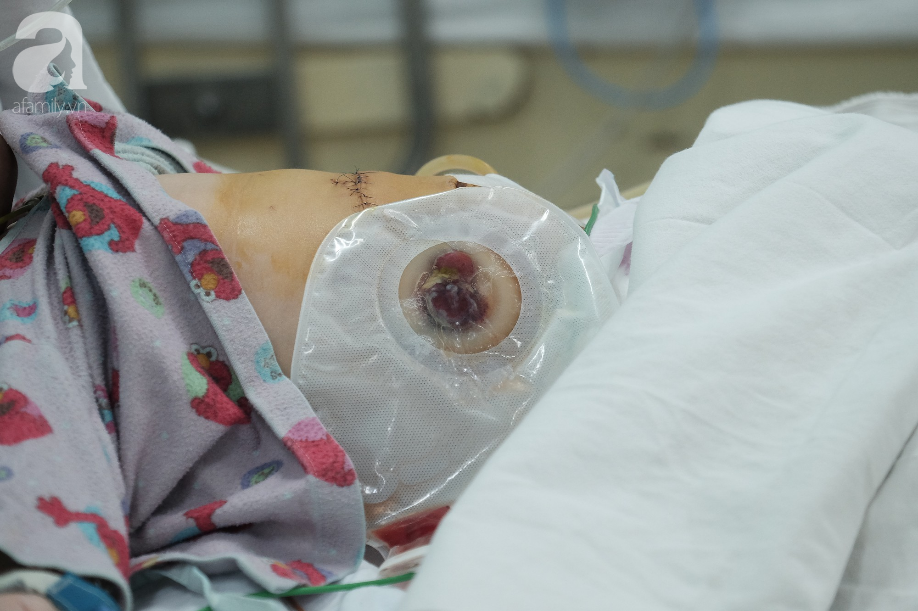 Bà ngoại bé trai bị mẹ đâm nhiều nhát thủng ruột: Tôi tưởng nó về thăm con, đâu có ngờ nó muốn giết con