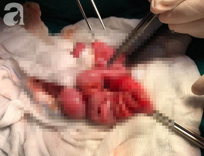 Bà ngoại bé trai bị mẹ đâm nhiều nhát thủng ruột: Tôi tưởng nó về thăm con, đâu có ngờ nó muốn giết con