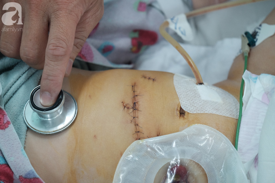 Bà ngoại bé trai bị mẹ đâm nhiều nhát thủng ruột: Tôi tưởng nó về thăm con, đâu có ngờ nó muốn giết con