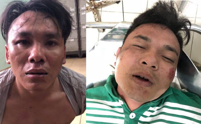 Hai thanh niên cướp xe máy, cầm mã tấu cố thủ trong khách sạn, công an nổ súng vây ráp