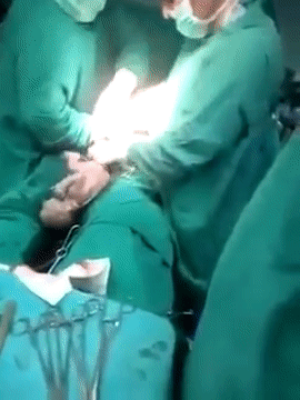 Hiếm thấy: Clip sinh mổ khiến các bác sĩ trong nghề lẫn người xem nín thở vì đếm mãi không hết số thai nhi