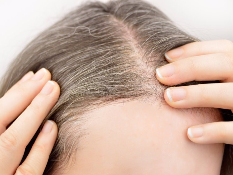 10 dấu hiệu cho thấy bạn đang thiếu sắt