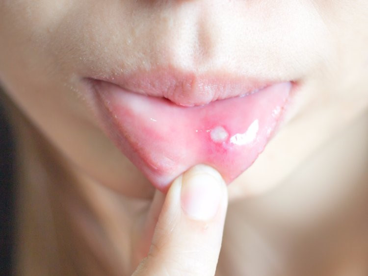 10 dấu hiệu cho thấy bạn đang thiếu sắt