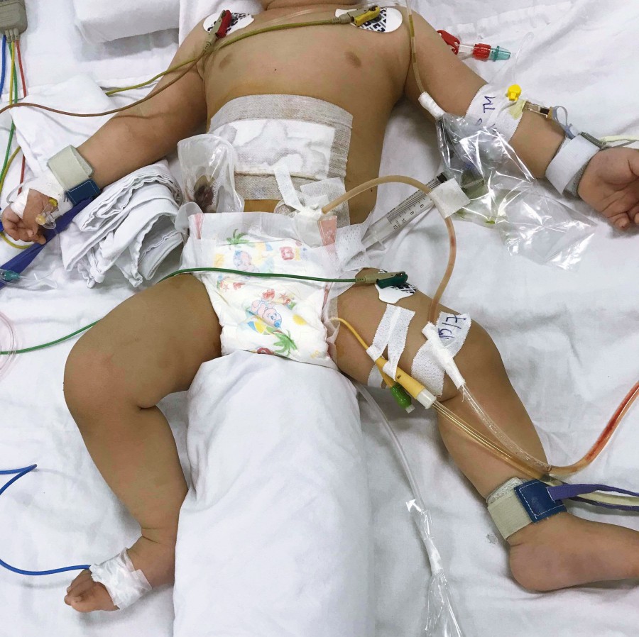 Vụ bé trai nghi bị mẹ ruột mắc bệnh tâm thần đâm thủng ruột ở Sài Gòn: Người mẹ có phải chịu trách nhiệm hình sự?