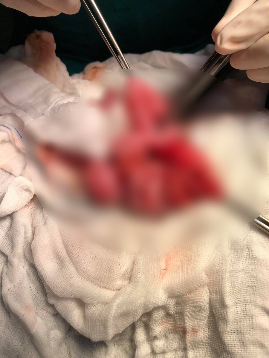 Vụ bé trai nghi bị mẹ ruột mắc bệnh tâm thần đâm thủng ruột ở Sài Gòn: Người mẹ có phải chịu trách nhiệm hình sự?