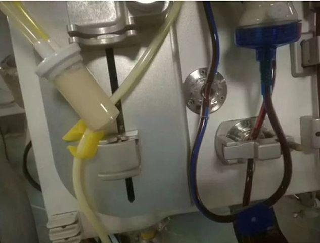 Bác sĩ giật mình khi máu bệnh nhân có lớp váng như mỡ, do ăn những món ai cũng thích