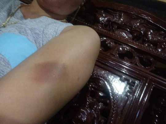 Tố trưởng công an xã hành hung khi chấm dứt quan hệ bất chính